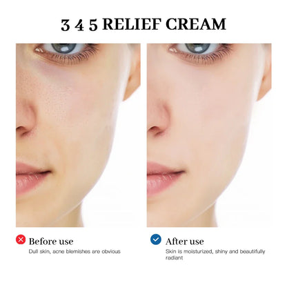 Blemish Recovery Barrier Relief Cream